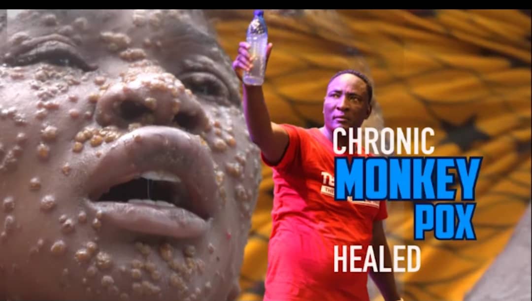 Woman Miraculously Healed Of Monkey Pox at Prophet Fufeyin’s Church